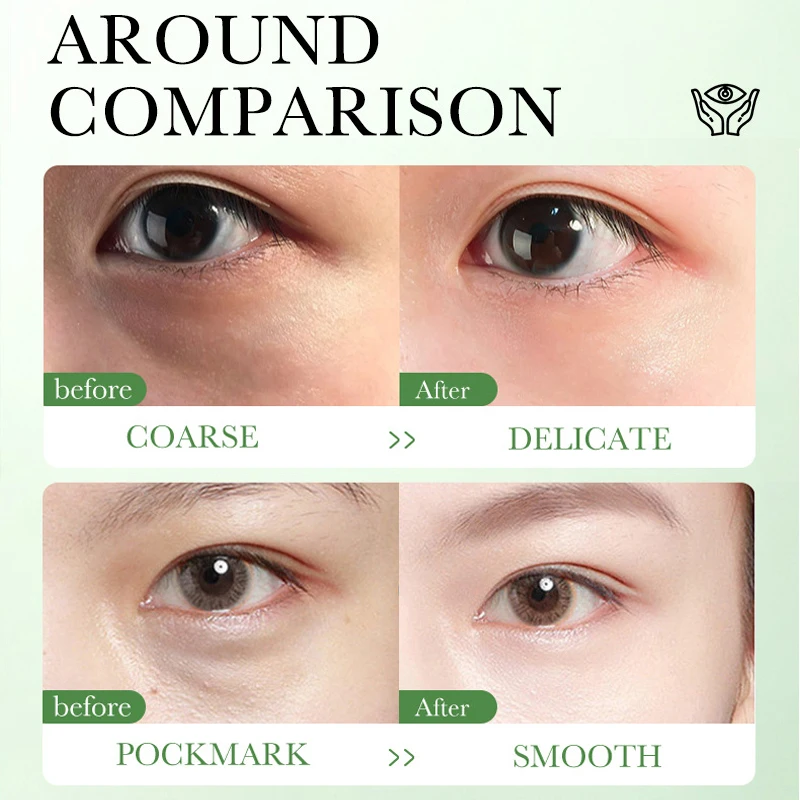 Centella Asiatica Eye Cream Mo - Beauty Huda Makeup ulasan dan harga